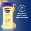 Vaseline Body Lotion Intensive Care Dry Skin Repair 200ml Pure Oat Extract, 72hr Moisturisation, Lock in Moisture 67315956 (Pack of 3)