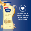 Vaseline Intensive Care Body Lotion Dry Skin Repair 625ml (Pack of 3pcs)