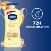 Vaseline Intensive Care Body Lotion Dry Skin Repair 625ml (Pack of 3pcs)